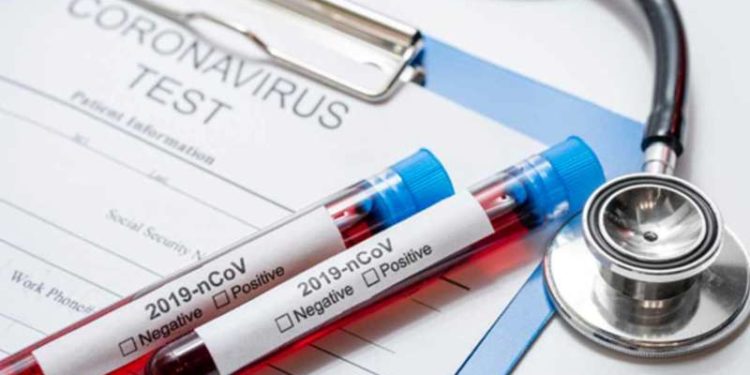 Vizag reports new spike in coronavirus cases, district tally goes upto 164