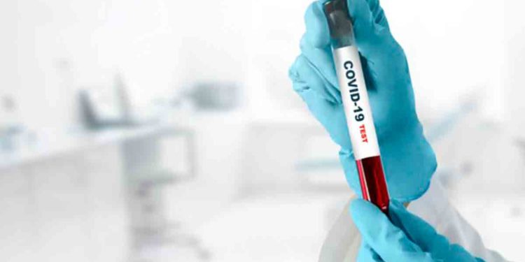 Total number of COVID-19 cases in Andhra Pradesh crosses 25,000