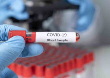 COVID-19 Update: Vizag reports 97 new infections